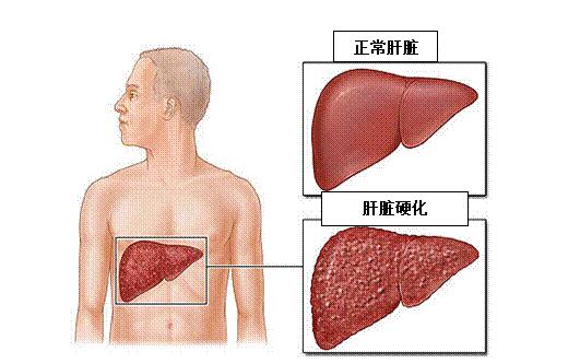 研究证明:人脐带间充质干细胞能治疗多种临床疾病 研究证明:人脐带间充质干细胞能治疗多种临床疾病