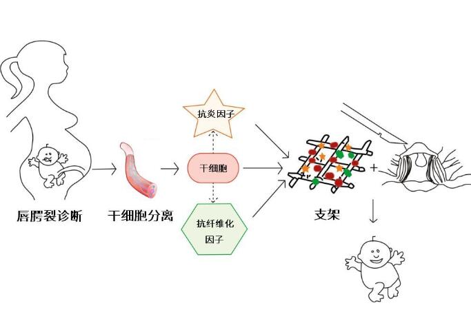 研究证实:脐带血或脐带是唇腭裂治疗中理想的干细胞来源 研究证实:脐带血或脐带是唇腭裂治疗中理想的干细胞来源