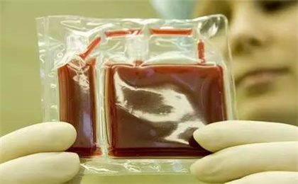 生命银行——脐带血与干细胞治疗的关系及作用.jpg